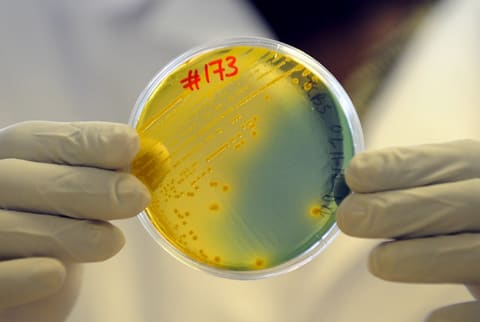 cholera-bacteria_5162890072_o