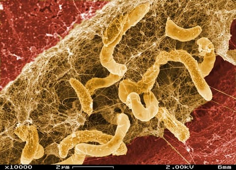 Biofilm of Desulfovibrio Desulfuricans