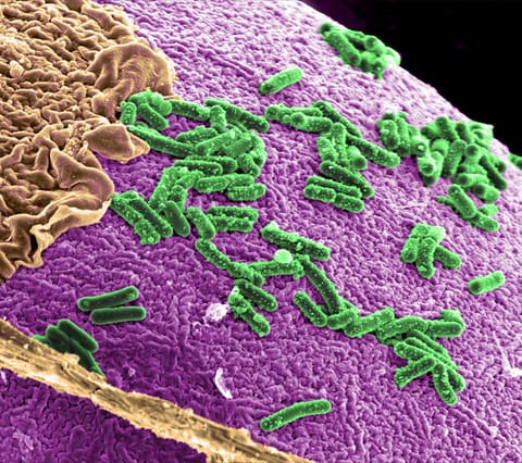 Improving Human Intestinal Health